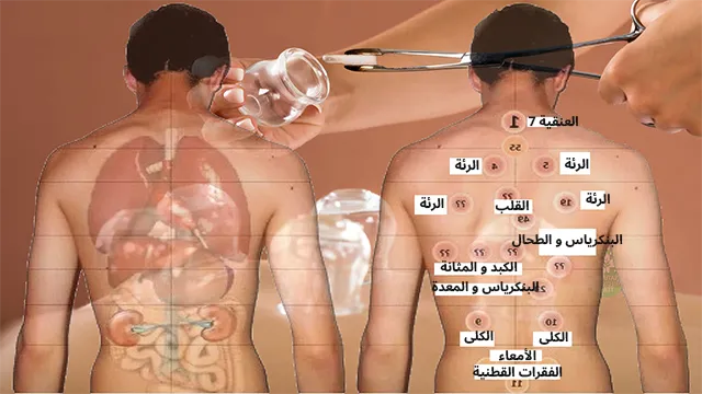 أفضل أيام الحجامة لشهر نوفمبر